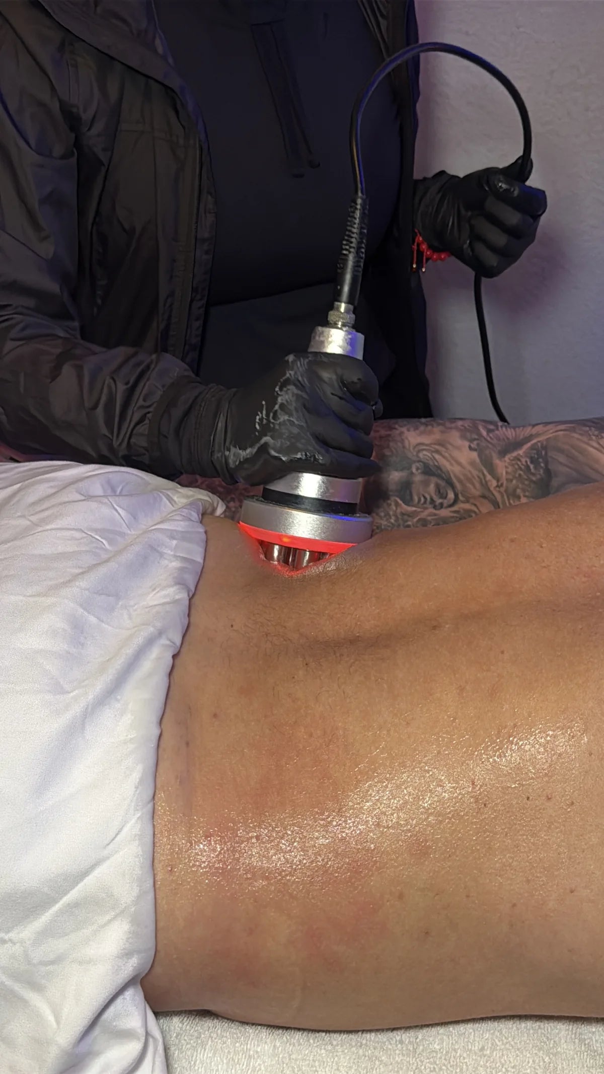 InstaSculpting treatment in progress in a professional setting